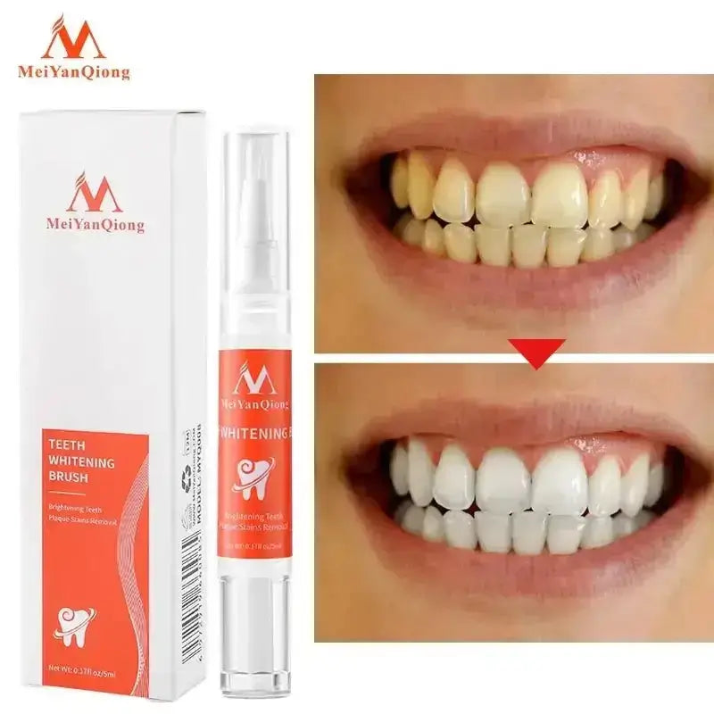 Teeth Whitening Pen VIP-Cosmetics